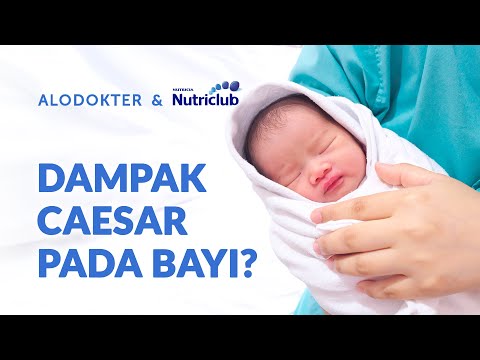 Video: Kapan anestesi digunakan pada bayi?