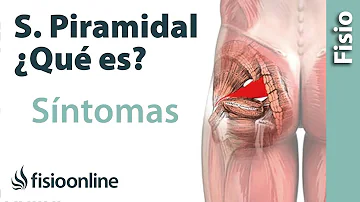 ¿Cuál es la causa de la inflamación del músculo piriforme?