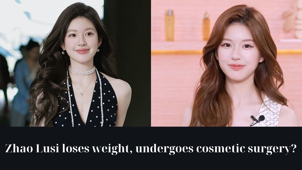 zhao lusi plastic surgery Image 4