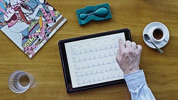 AI-Powered ECG Analysis