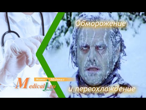 Обморожение конечностей и общее переохлаждение