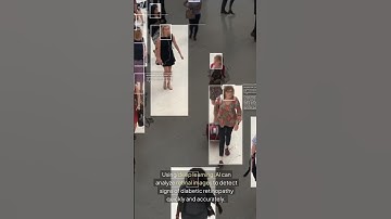 Diabetic Retinopathy Detection Using Deep Learning Explained!