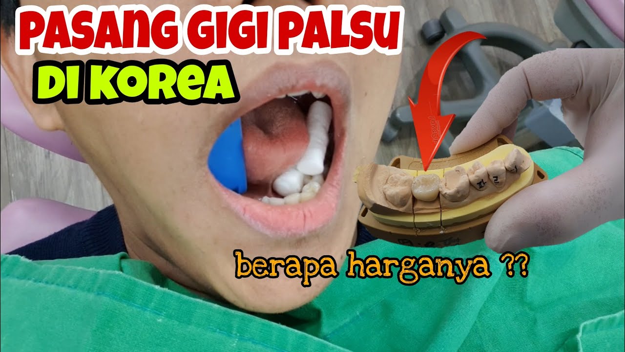 Pasang Gigi Palsu Di Korea Harganya Bikin Kaget Youtube