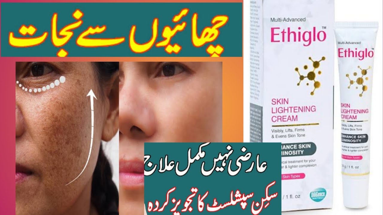 Ethiglo Skin Lightening Cream For Freckles Review YouTube Ethiglo Skin Lightening Cream For Freckles Review YouTube