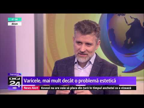 Video: Diferența Dintre Tromboza Venoasă Profundă și Varicele