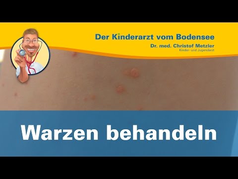 Warzen behandeln - Der Kinderarzt vom Bodensee [Warzen 2/2]