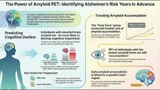 Quantifying the Earliest Signals of Alzheimer’s Disease: Baseline Amyloid PET as a Predictor-Podcast