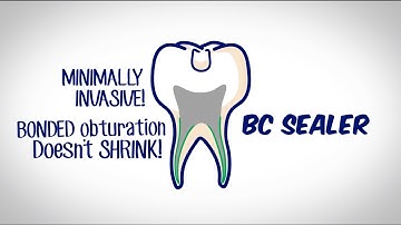 A Whiteboard Introduction Video of BC Sealer