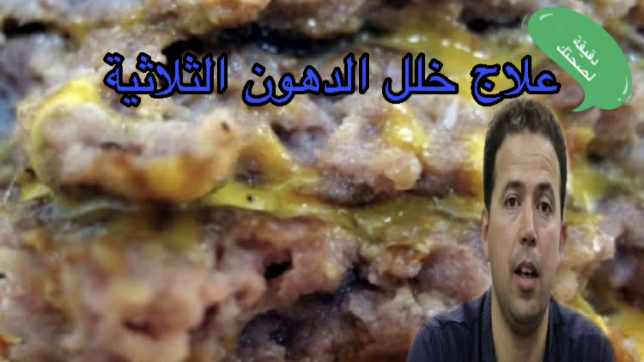 علاج خلل تزايد الدهون او الشحوم الثلاثية(تريغليسيريد) بسهولة- الدكتور محمد احليمي