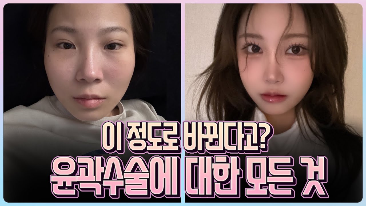 [Эйтоп гоо сайхны мэс заслын эмнэлэг] Нүүрний хэлбэр засах мэс заслын талаарх ташаа ойлголтыг 🤔 өнөөдөр бид арилгана ✨