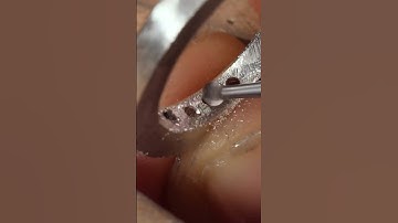 Have you ever heard of a castle setting or split claw setting?