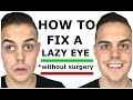 How to Fix a Lazy Eye With One Crazy Trick