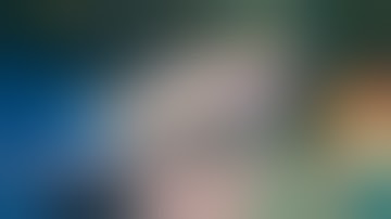 Thay khớp háng toàn phần chuyển động kép tốt nhất cho hoại tử chỏm xương đùi người trẻ