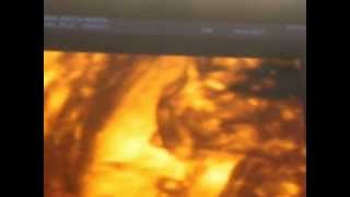 Bb Sofia Eco 19 Semanas