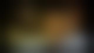 Conjoined Twins Separation (Ahmed & Mohamed) - Part 3