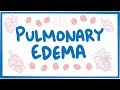 Pulmonary edema  causes symptoms diagnosis treatment pathology