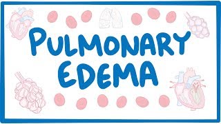Pulmonary Edema  causes, symptoms, diagnosis, treatment, pathology