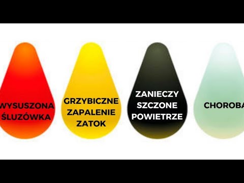 Wideo: Wykres Koloru Smarków: żółty, Zielony, Brązowy I Więcej