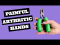 Painful Arthritic Hands? 15 Things to Try Right Now!