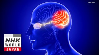 Glaucoma The Fight To Prevent Blindness  Medical Frontiers