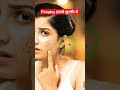 photoshop tutorial in hindi | how to remove pimple in photoshop #shortsfeed #shorts #short
