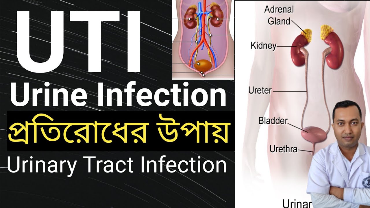 Urinary Tract Infection In Bengali Uti Cause symptoms ইউরিন