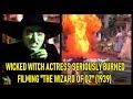 Wicked Witch Actress Seriously Burned Filming "Wizard Of Oz" (1939)