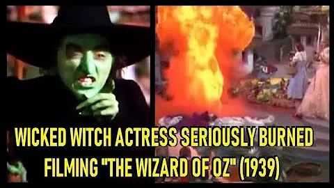 Wicked Witch Actress Seriously Burned Filming "Wizard Of Oz" (1939)