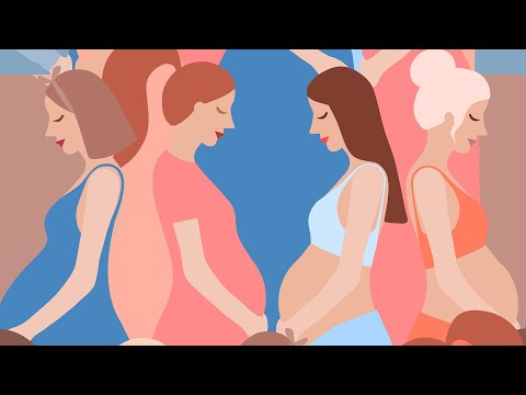 Birth Outcomes Among Pregnant Women With Mood and Anxiety Disorders by McLeanHospital