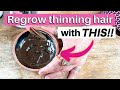 Regrow your thinning edges with this super simple hair growth mask!