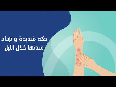 أعراض الاكزيما