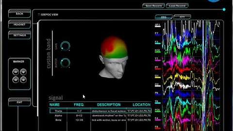 Brain Computer Interface: 3D Brain Imaging Map
