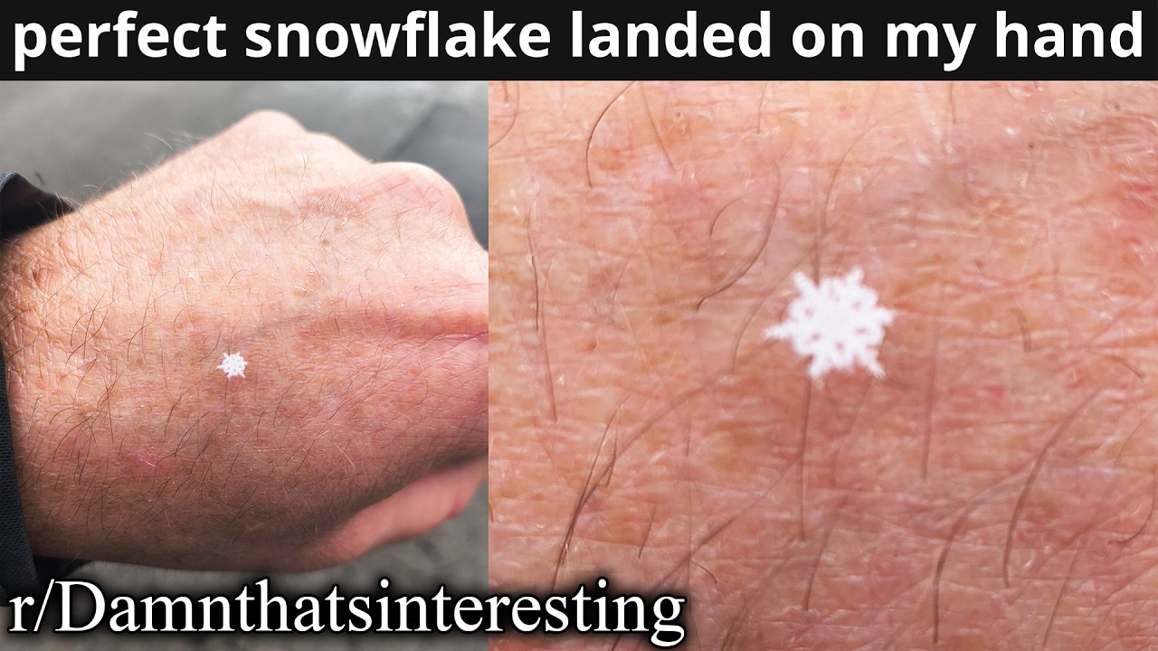 r/Damnthatsinteresting | SO LITTLE