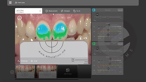 Creating a patient personal shade matching recipe using eLAB_prime!