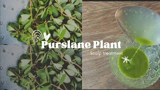 Alopecia hair care day |Purslane plant extract on scalp | Alopecia scalp treatment