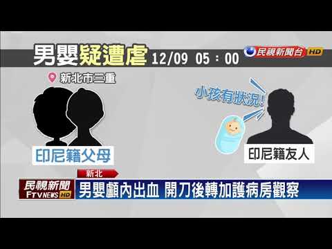 印尼籍男嬰疑遭虐 顱內出血緊急開刀－民視新聞