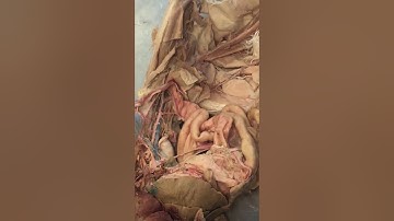 Simpson A&P 2 Cat Dissection Veins and Arteries