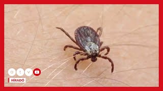 A Legsúlyosabb Kullancs Által Terjesztett Fertőzés Tűnt Fel Zalában