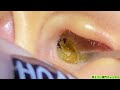 ASMR：これは…耳じゃなくて洞窟！？