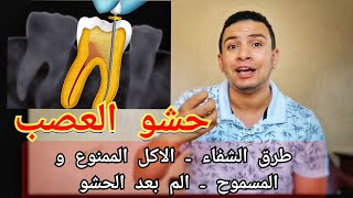 طرق الشفاء العاجل بعد حشو العصب| تعليمات بعد حشو العصب| الاكل المسموح و الممنوع بعد حشو العصب