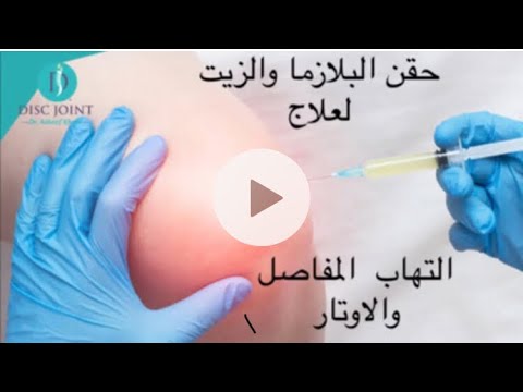  18 2021 كل شئ عن حقن البلازما والزيت لعلاج الخشونة والتهاب الاوتار دكتور اسامة لطفي ابوزيد