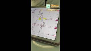 วันหยุด วางแผนการเทรดทองคำ วันที่ 13 ตุลาคม 2568