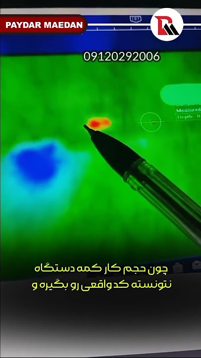 این اسکن با دستگاه پروتون ۸ سنسور شرکت آسووا ترکیه گرفته شده  Proton elic lb8