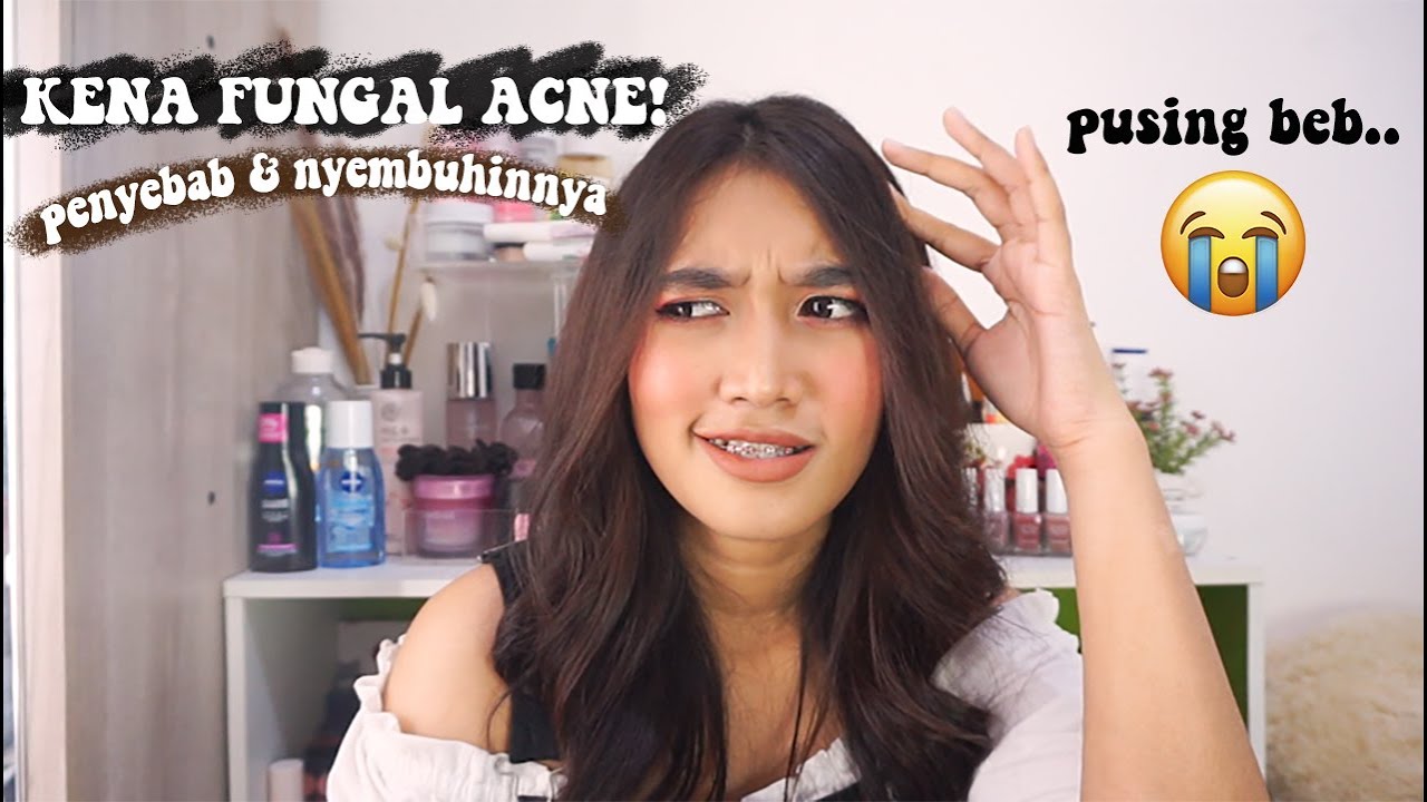 SERUM BENTON BIKIN FUNGAL ACNE?! Apa itu fungal acne, penyebab dan cara