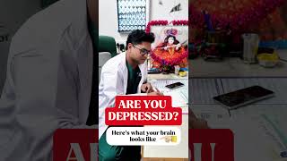 Depression and Brain Function #shorts #viral #brain #depression #function #foryou #explore #youtube