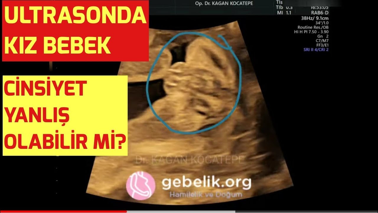 kiz bebek bazen neden erkek gibi gorunur ultrasonda cinsiyetin yanlis bakilmasi mumkun mudur youtube