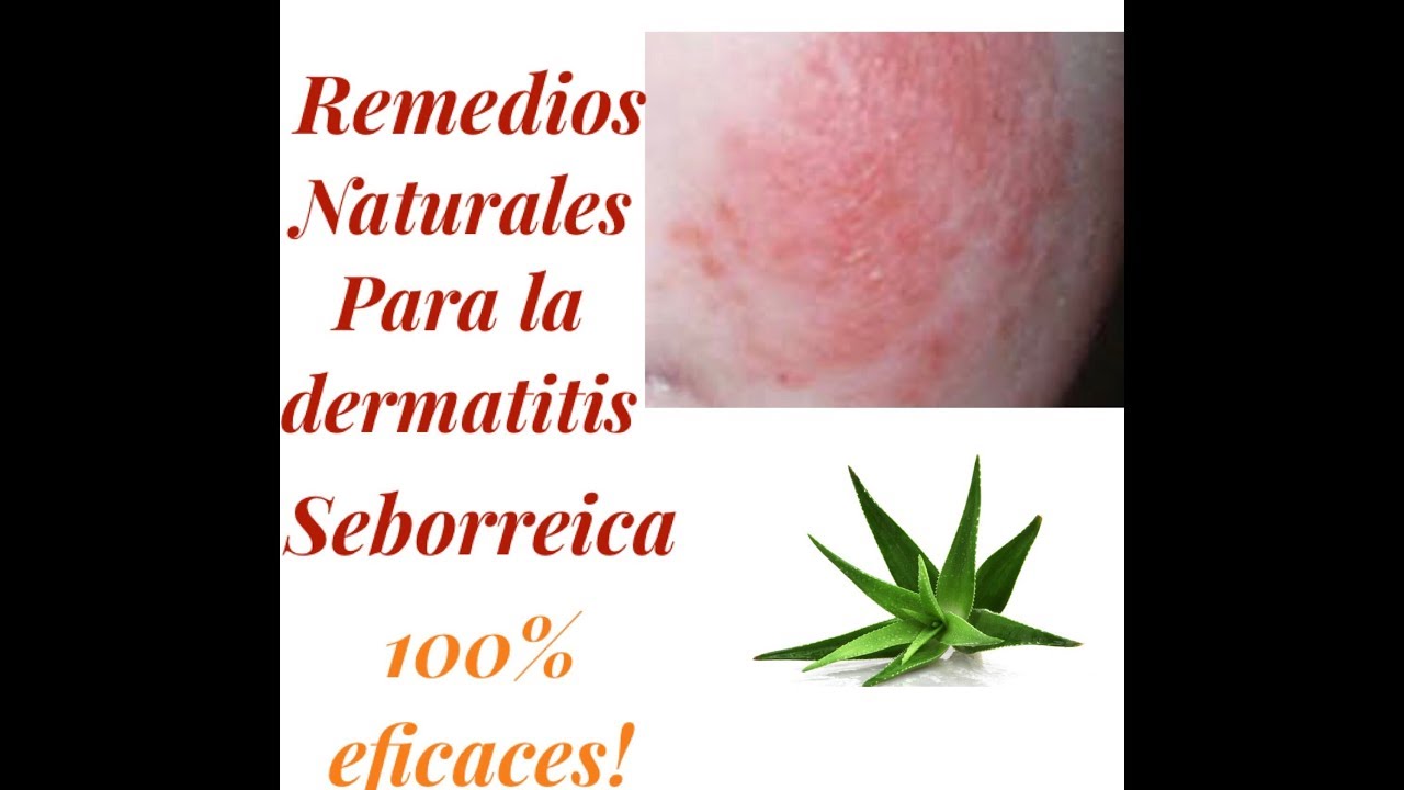 Remedios caseros para la Dermatitis seborreica 😱 YouTube