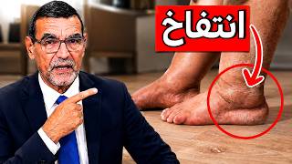 الفيتامين الأقوى لتخفيف التهاب المفاصل الروماتويد و تورم وانتفاخ الساقين والكاحلين