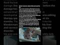 Nine-month-old KJ was born with a genetic disorder that prevented his liver from processing ammonia