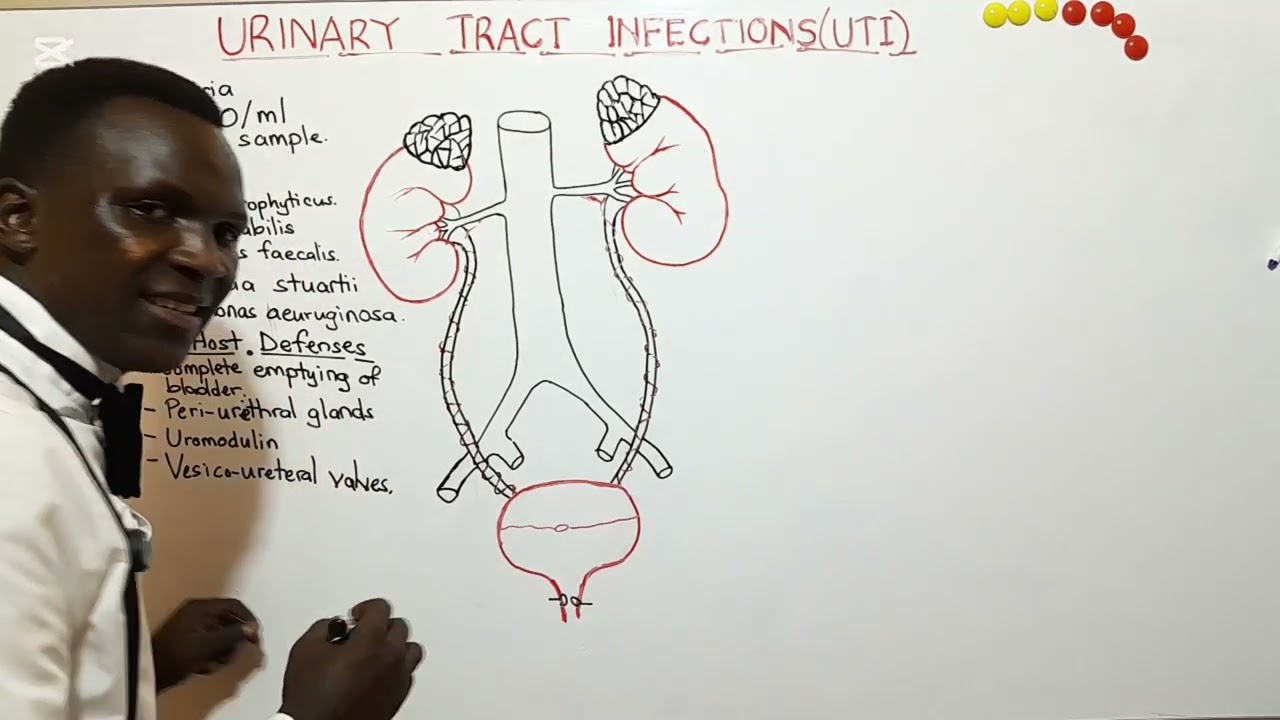 Urinary Tract Infection -Definition,Causes, Defense mechanisms & Types
